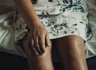 Zapalenie stawów – jak leczyć?