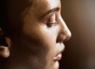Walka z trądzikiem: Acne-derm krem przeciwtrądzikowy i wybielający w akcji